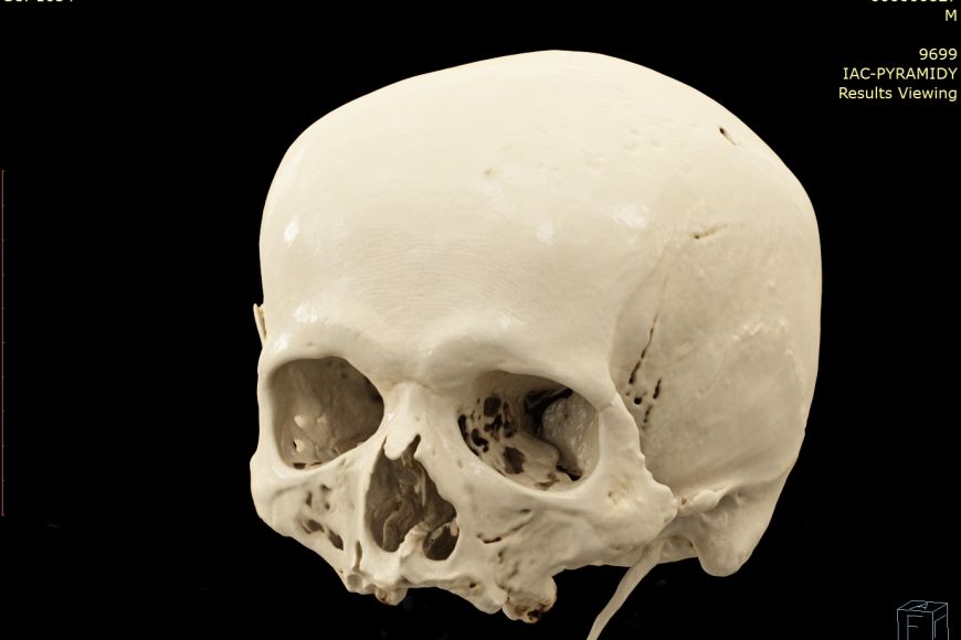 Podle rentgenového snímku vymodelovali vědci 3D model lebky G. J. Mendela.
